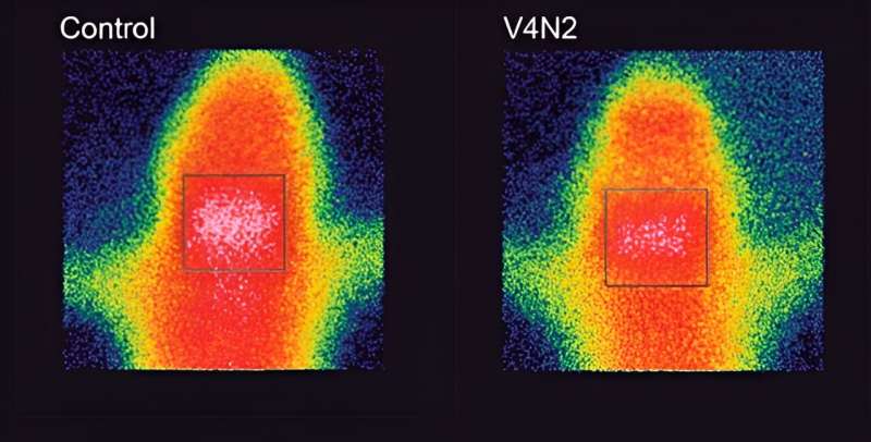 Scintigraphy shows that many more cocaine molecules reached the brain of pregnant rats that received a placebo than those that received the vaccine. Credit: Vulnerability and Health Research Centre (NAVES/UFMG). Núcleo de Pesquisa em Vulnerabilidade e Saúde (NAVES/UFMG)