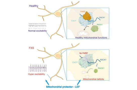 Discovery reveals fragile X syndrome begins developing even before birth