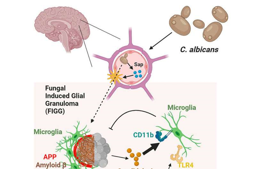 Brain fungal infection produces Alzheimer's disease-like changes, says new study