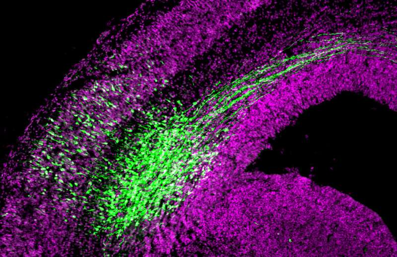 New mechanisms regulating neural stem cells 