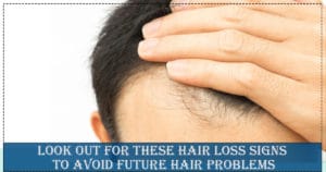 Look-Out-for-These-HAir-Loss-Signs-To-Avoid-Future-hair-problems-300x158