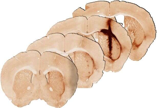 New hydrogel stem cell treatment repairs injured brain tissue in mice 