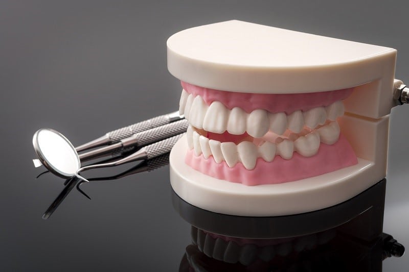 Know the Benefits of Specialist for Denture Implants