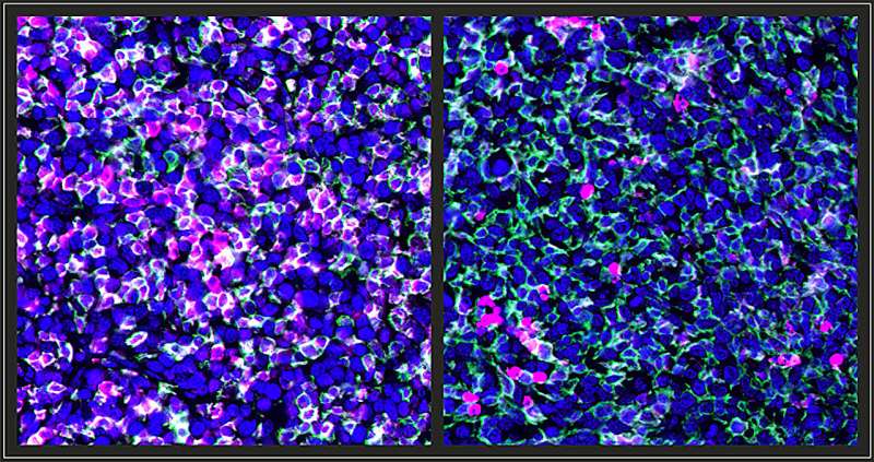 Study finds carcinogen exposure makes cancer cells more susceptible to immune attack, with implications for treatment