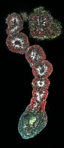 Immunofluorescence staining of human pluripotent stem cell derived axioloids