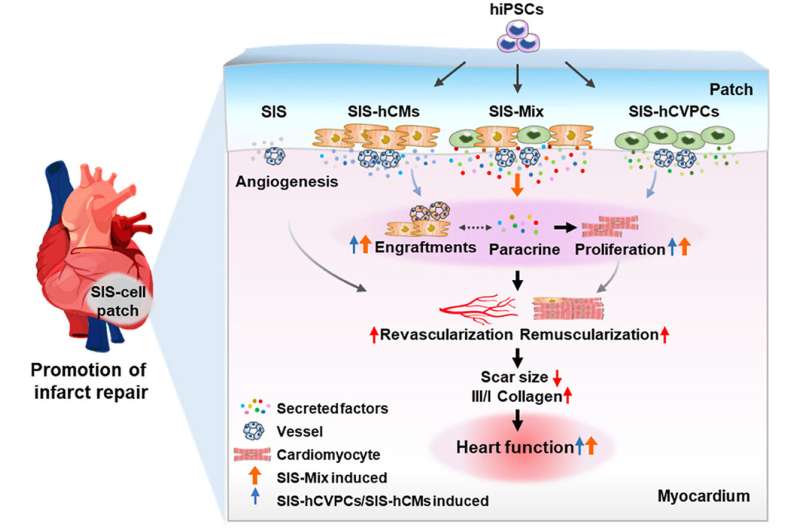 Strategy for cardiac repair using stem cell–derived progenitor cells and cell-seeding matrix patches