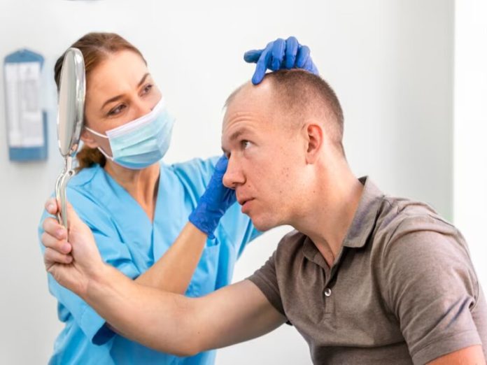 Avantages d'une greffe de cheveux avec la technique FUE