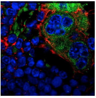 Mutations in bone cells can drive leukemia in neighboring stem cells