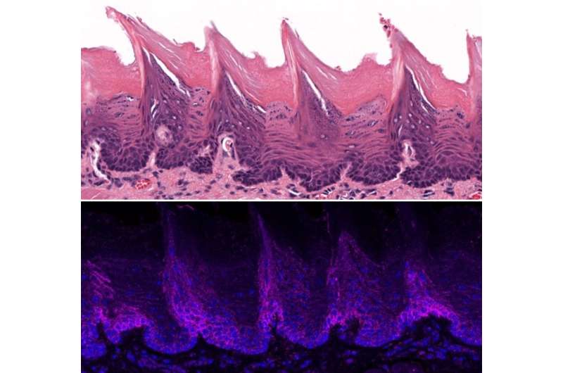 Tissue from a mouse tongue as seen under a microscope (top) and localization of the ORAI1 protein in the tissue on surface of the mouse tongue (bottom). Credit: Lacruz Lab/NYU