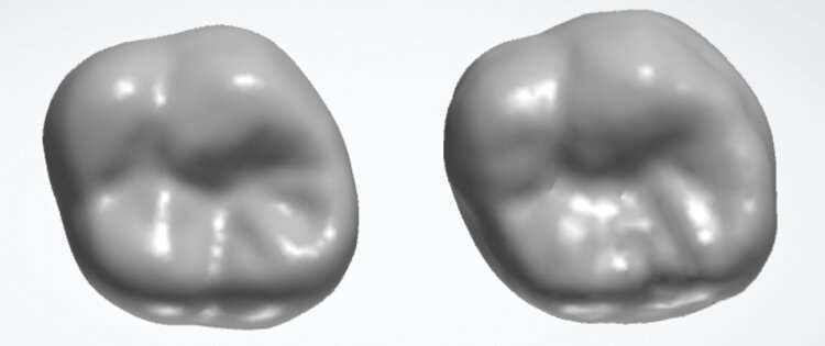 Natural tooth (left) compared with tooth tailored by generative AI (right). Credit: The University of Hong Kong