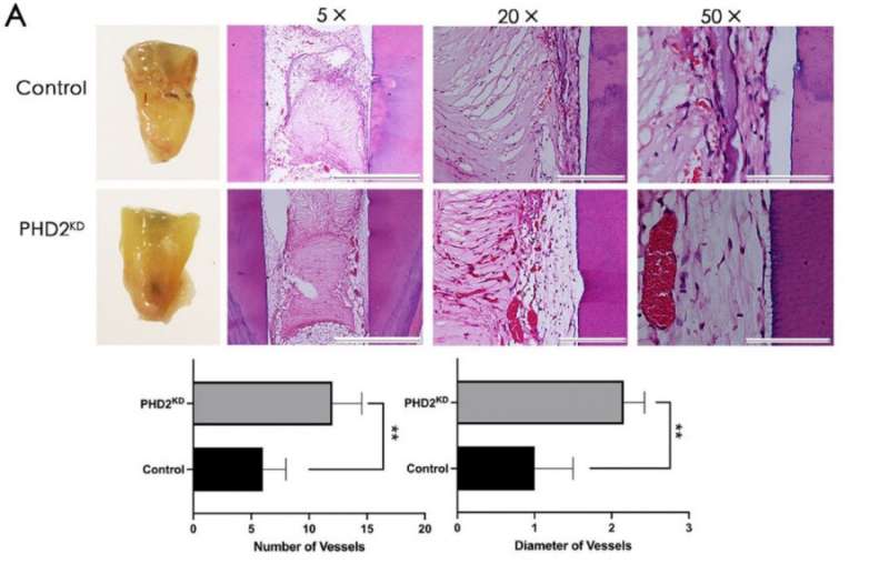 Tooth stem cells modified to mimic a cellular state similar to that under low oxygen (PHD2KD) gave rise to tooth pulp tissue with a significantly increased amount of blood vessels. Credit: The University of Hong Kong