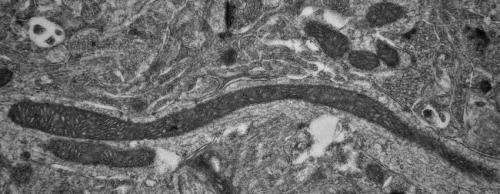 This image shows Parkinson's Disease mitochondria, the subject of the study awarded the Medical Research Council Grant of £500,000 (Sterling). Credit: Plymouth University Peninsula Schools of Medicine and Dentistry