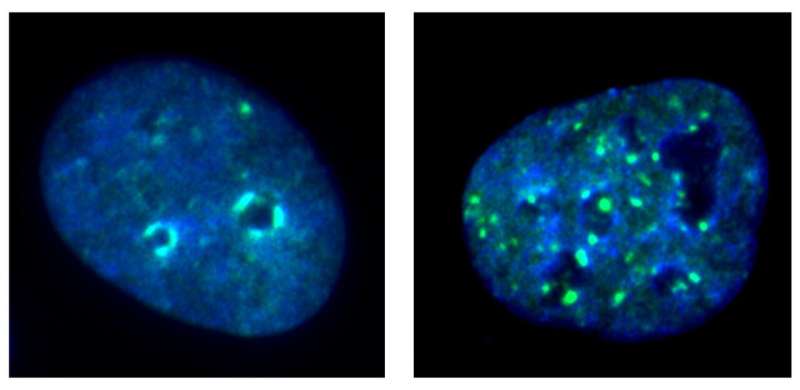 Immunofluorescence images of cancer cells with and without KDM4A. Credit: UCLA School of Dentistry