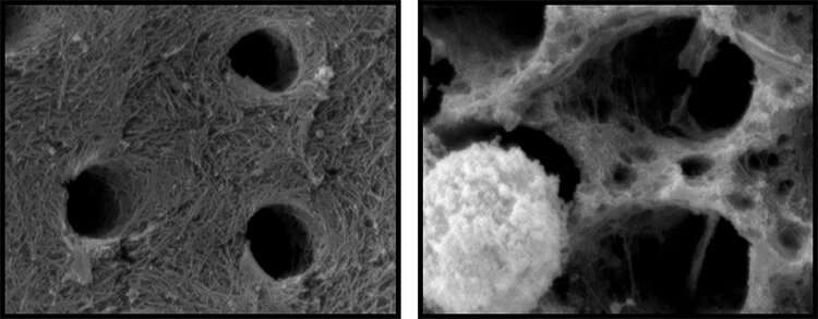 Collagen after incubation with neutrophils for 24 hours: Image at right depicts a loss of collagen fibril network when incubated with neutrophils. Credit: Russel Gitalis