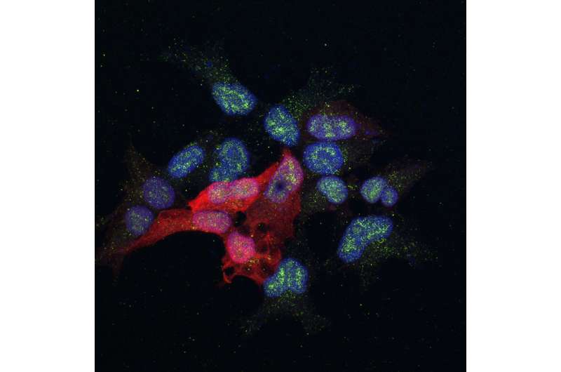 Cells to study a protein (green) involved in the metastasis of breast cancer. Credit: Alicia Llorente. IRB Barcelona