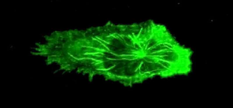 A crawling neutrophil, tubulin labeled green. Neutrophil activationis now believed to be at the root of overactive inflammatory responses, and links conditions such as periodontal disease and heart disease. Credit: Noah Fine