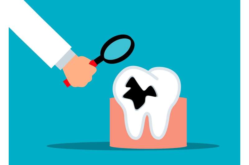 New tooth decay treatment guideline released