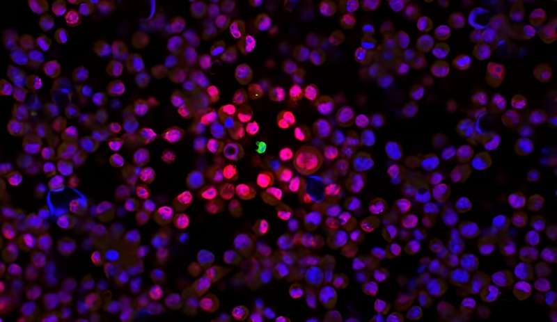 A microscope image of melanoma cells. The green T cell in the center has been activated and is producing interferon-gamma (pink/red), a signaling molecule necessary for certain cancer immunotherapies to work. The Oyler-Yaniv lab is studying how interferon-gamma spreads through dense tissues in the body. Credit: Oyler-Yaniv lab