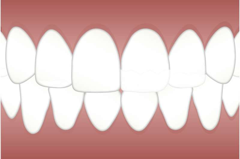 Evolution of aesthetic dentistry