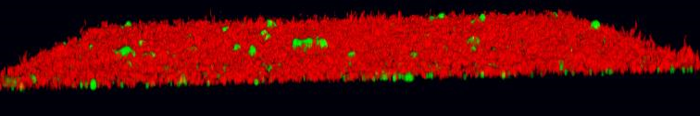 In the presence of the inhibitor, P. gingivalis (green) is prevented from adhering to S. gordonii (red) and biofilm production is significantly reduced. Credit: UofL