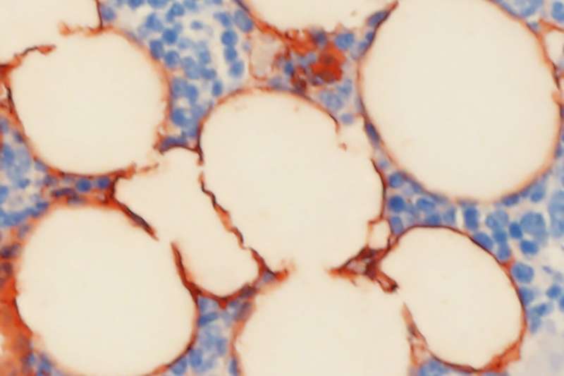 A loss of the epigenic factor KDM4B promotes the accumulation fat cells in the bone marrow (pictured here) of aging mice, researchers found. Credit: Peng Deng/UCLA School of Dentistry