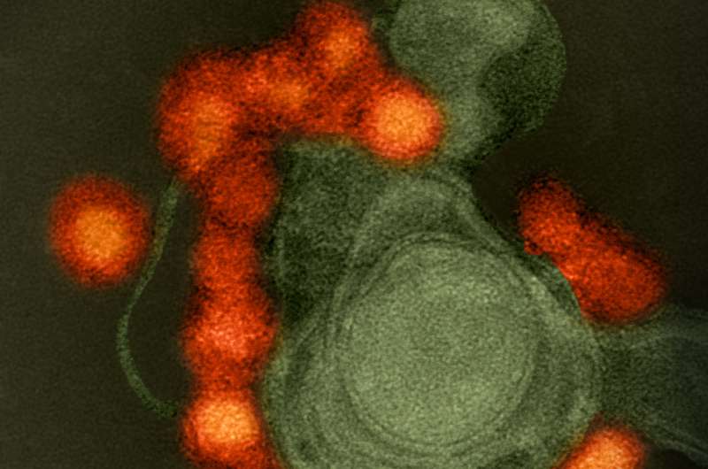 Transmission electron microscope image of negative-stained, Fortaleza-strain Zika virus (red), isolated from a microcephaly case in Brazil. The virus is associated with cellular membranes in the center. Credit: NIAID