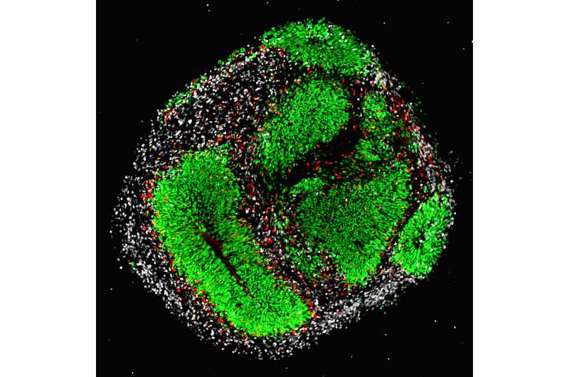 Lipid metabolism controls brain development