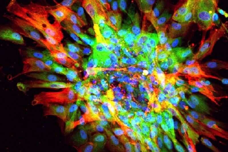 Researchers create accurate model of organ scarring using stem cells in a lab