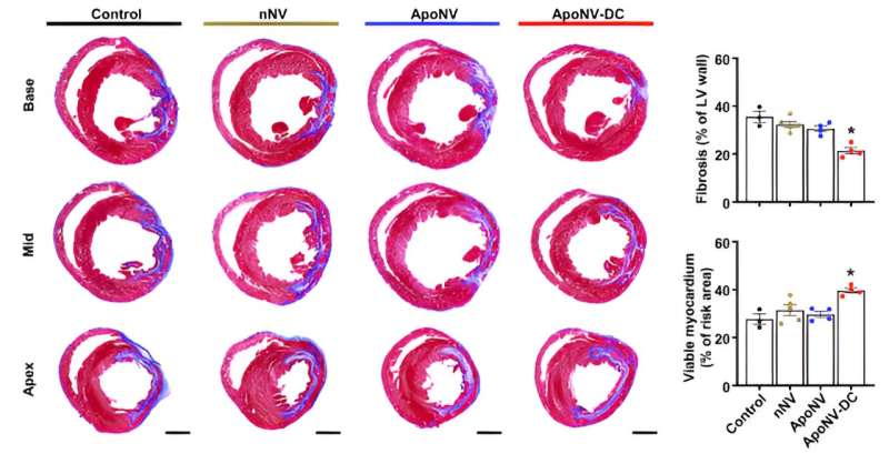 Myocardial infarction, the number one cause of sudden death, may be treated by modulating the immune response.