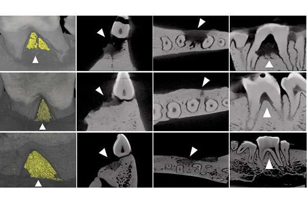 µCT analysis of new bone regeneration by allogeneic ADMPC. Credit: Masahiro Saito, Tohoku University