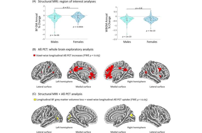 Cholinergic dysfunction worsens amyloid pathology in humans independently of biological sex. Credit: Alzheimer's & Dementia (2023). DOI: 10.1002/alz.13481