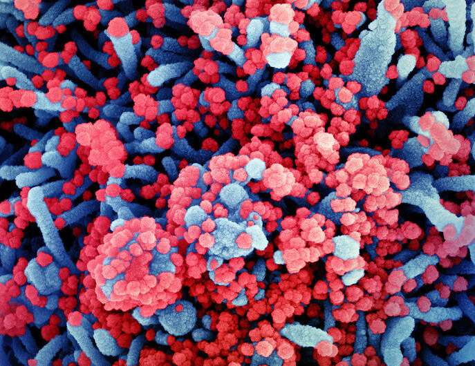 Colorized scanning electron micrograph of a cell (blue) heavily infected with SARS-CoV-2 virus particles (red), isolated from a patient sample. Image captured at the NIAID Integrated Research Facility (IRF) in Fort Detrick, Maryland. Credit: NIAID