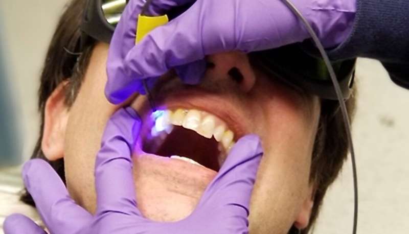 A new University of Washington dental tool prototype uses a low-power light system to monitor reactions with a florescent dye solution to find where tooth enamel is most at risk from the acidity of plaque. Credit: University of Washington and IEEE Xplore/Creative Commons