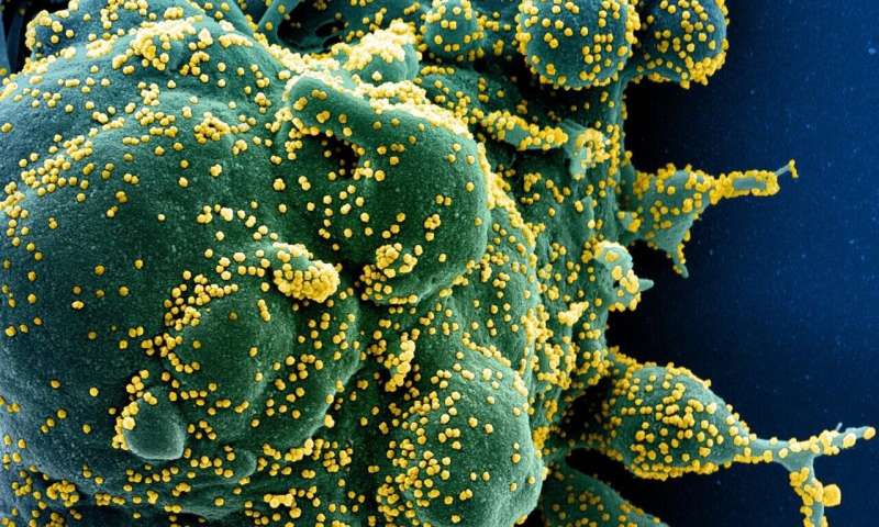 Colorized scanning electron micrograph of an apoptotic cell (green) heavily infected with SARS-COV-2 virus particles (yellow), isolated from a patient sample. Image captured at the NIAID Integrated Research Facility (IRF) in Fort Detrick, Maryland. Credit: NIH/NIAID