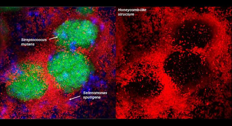 S. sputigena cells form a honeycomb-like structure that encapsulates S. mutans to greatly increase and concenntrate acid production that boost caries development and severity. Credit: Hyun (Michel) Koo