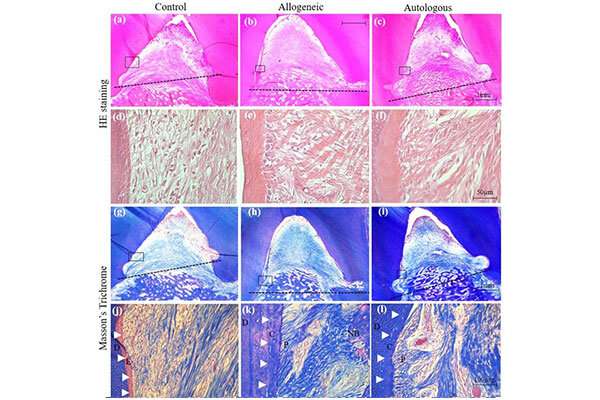 Histological analysis of periodontal regeneration by allogeneic ADMPC. Credit: Masahiro Saito, Tohoku University