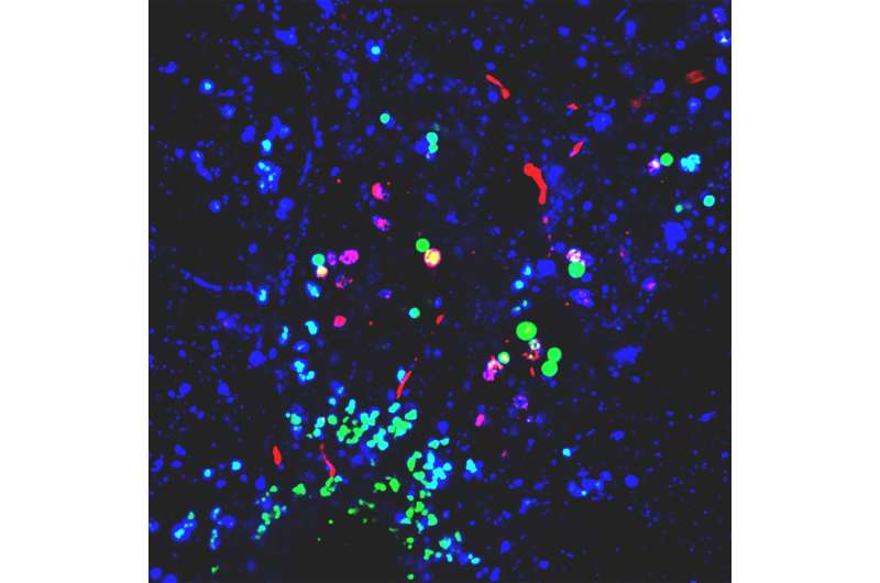 Nanoplastics promote conditions for Parkinson's across various lab models, study shows 