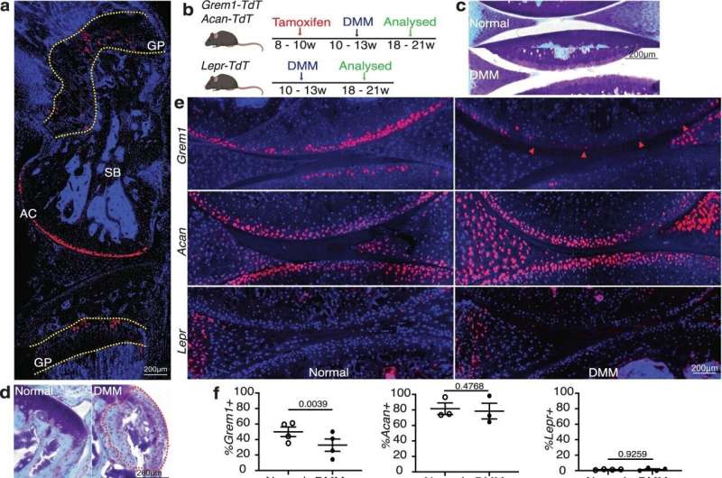 New hope to treat and reverse osteoarthritis