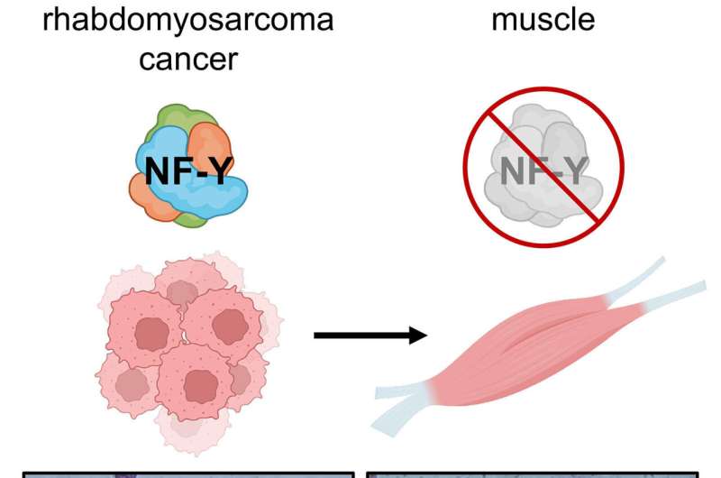 Once rhabdomyosarcoma, now muscle