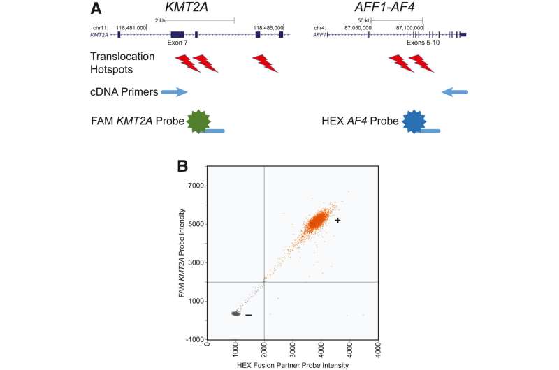 New assay could revolutionize detection and treatment of acute myeloid leukemia 