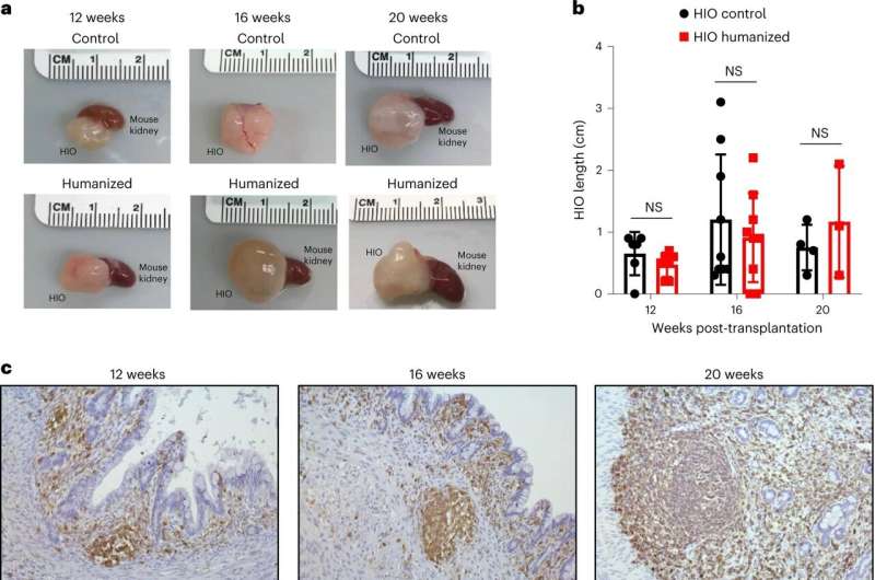 Miniature colons with immune components aid the study of intestinal diseases