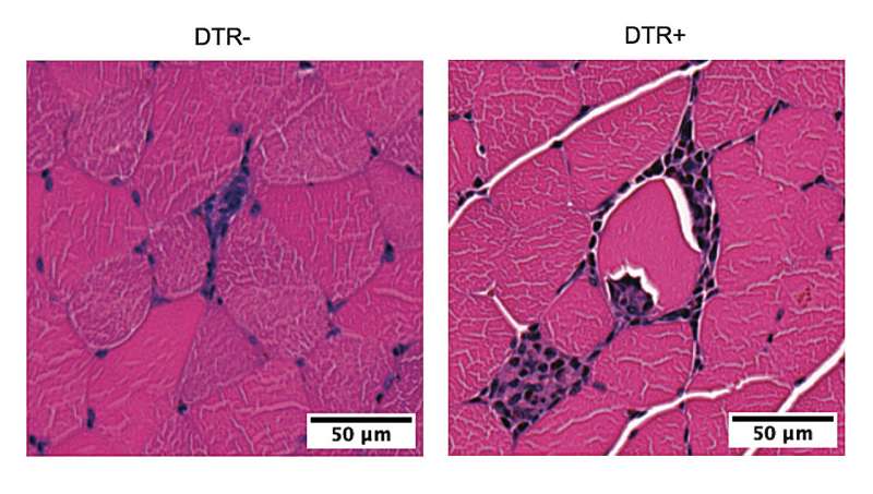 Some benefits of exercise stem from the immune system