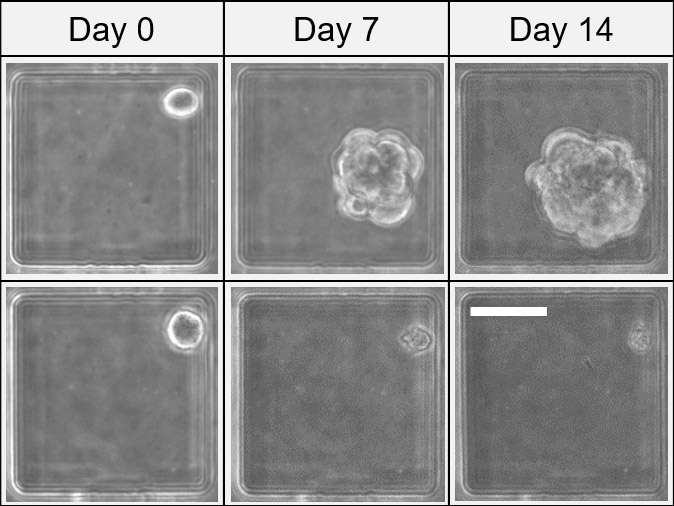 Cancer stem cells—new method analyzes 10,000 cells at once