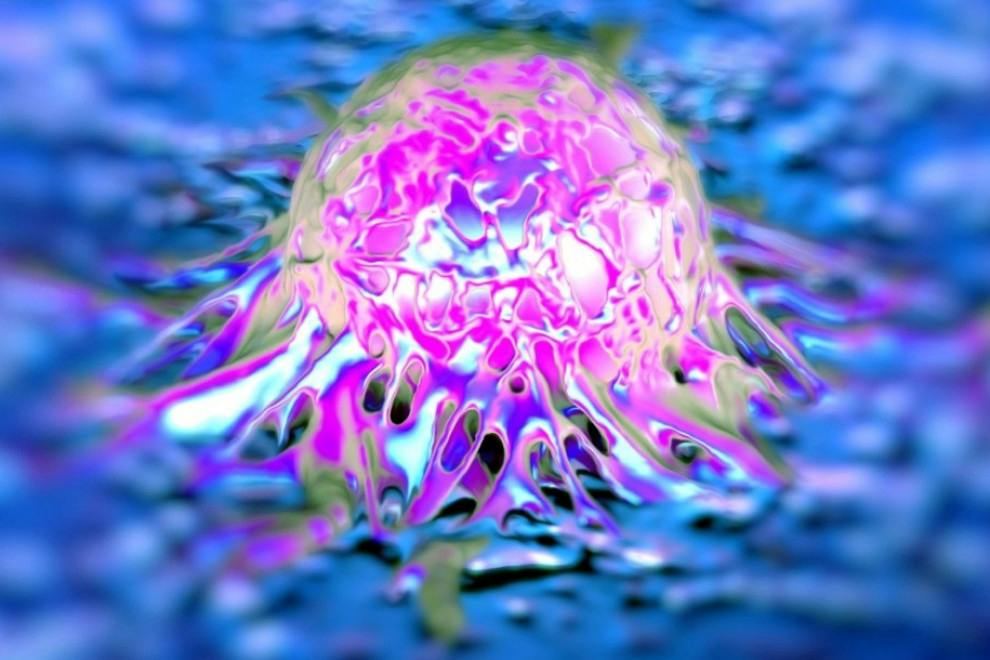 Los 10 tipos de cáncer más raros