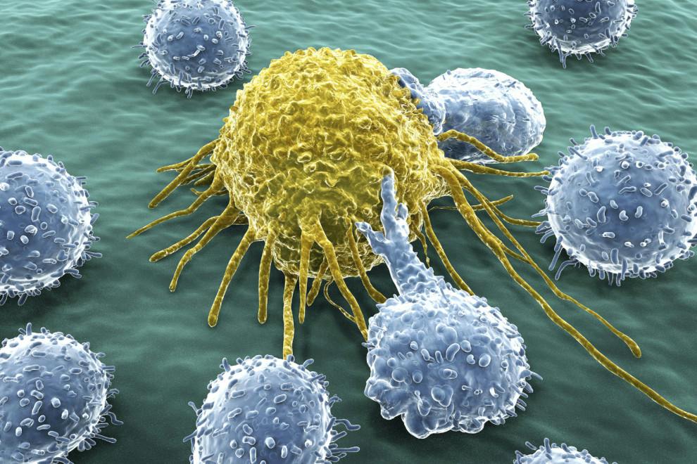 Las 7 diferencias entre tumor y cáncer