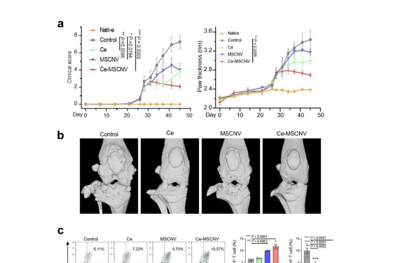 New nanoparticles found to be effective for the treatment of rheumatoid arthritis