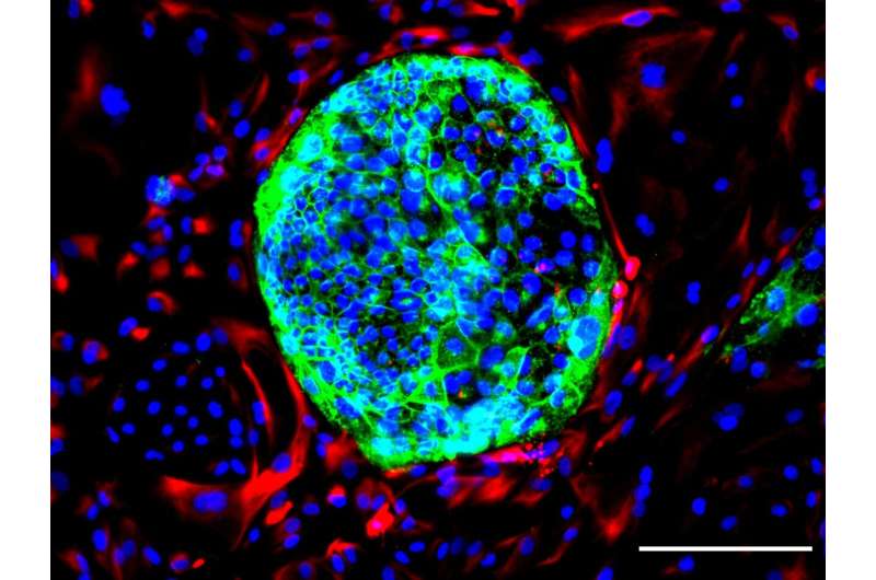 Stem cell biologists create new human cell type for research 