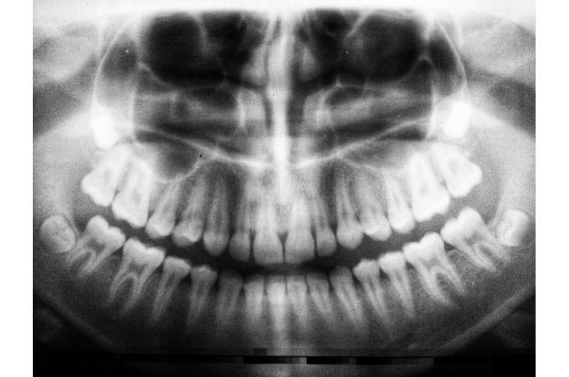 dental x-ray