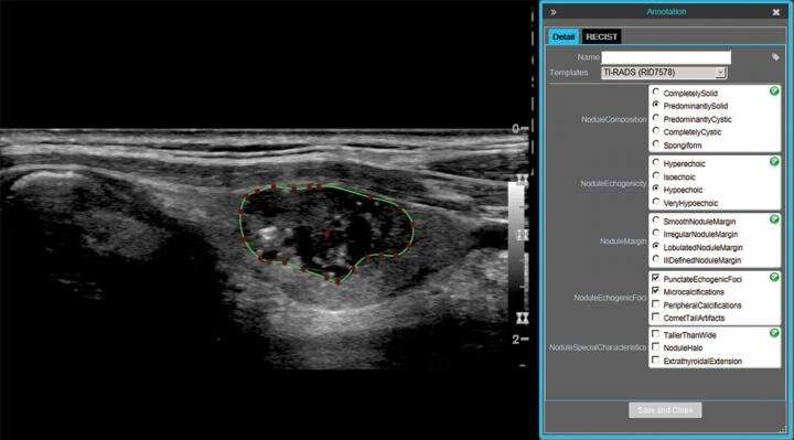 AJR researchers take step toward automating thyroid cancer triage