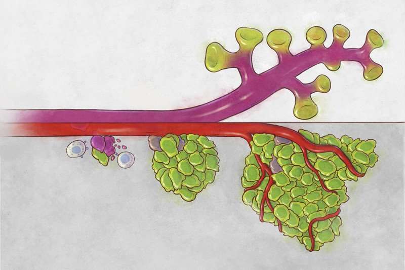 Shape-shifting stem cells are key to cancer metastasis and immune evasion